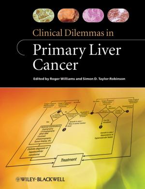 Cover of the book Clinical Dilemmas in Primary Liver Cancer by Helmut F. van Emden