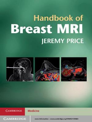 Cover of the book Handbook of Breast MRI by Kathleen Thompson