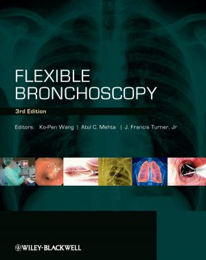 Cover of the book Flexible Bronchoscopy by Pete Gregory, Ian Mursell