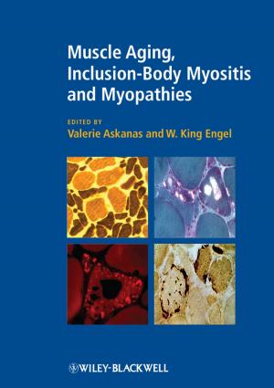 Cover of the book Muscle Aging, Inclusion-Body Myositis and Myopathies by CCPS (Center for Chemical Process Safety)