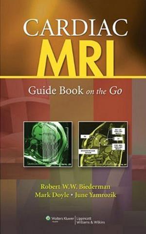 Book cover of Cardiac MRI: Guide Book on the Go