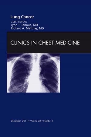 Cover of the book Lung Cancer, An Issue of Clinics in Chest Medicine - E-Book by Geoffrey R. Keyes, MD, Robert Singer, MD