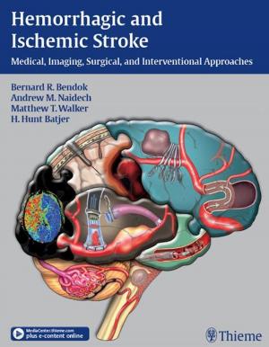 Cover of the book Hemorrhagic and Ischemic Stroke by Michael Schuenke, Erik Schulte, Udo Schumacher