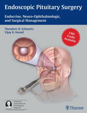 Cover of the book Endoscopic Pituitary Surgery by Charles James, Charles M. Glasier, Bruce S. Greenberg
