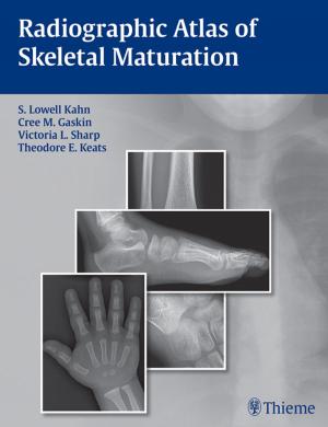 Cover of the book Radiographic Atlas of Skeletal Maturation by Eugene Yu, Nasir Jaffer, TaeBong Chung