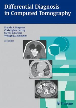 Cover of the book Differential Diagnosis in Computed Tomography by Christoph Frank Dietrich, Dieter Nuernberg