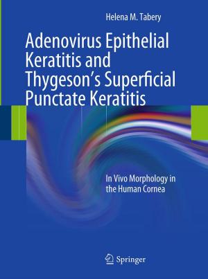 Book cover of Adenovirus Epithelial Keratitis and Thygeson's Superficial Punctate Keratitis