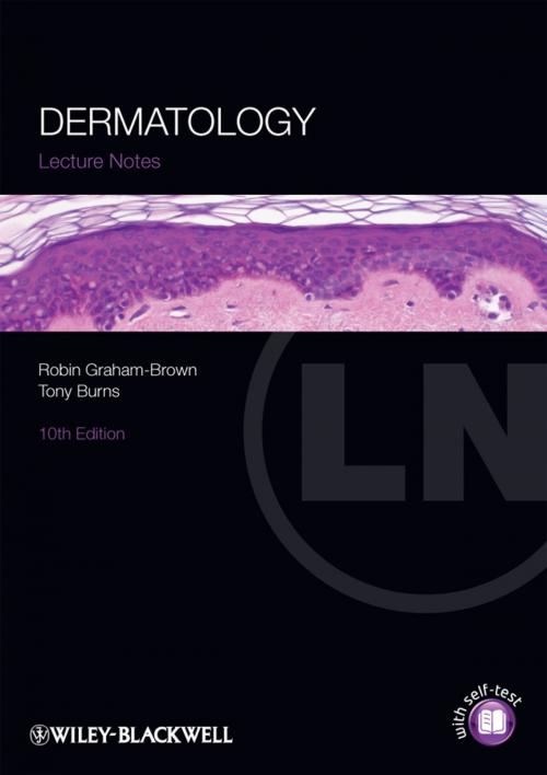Cover of the book Lecture Notes: Dermatology by Robin Graham-Brown, Tony Burns, Wiley