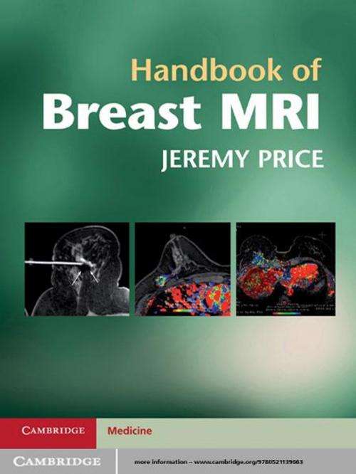 Cover of the book Handbook of Breast MRI by Jeremy Price, Cambridge University Press