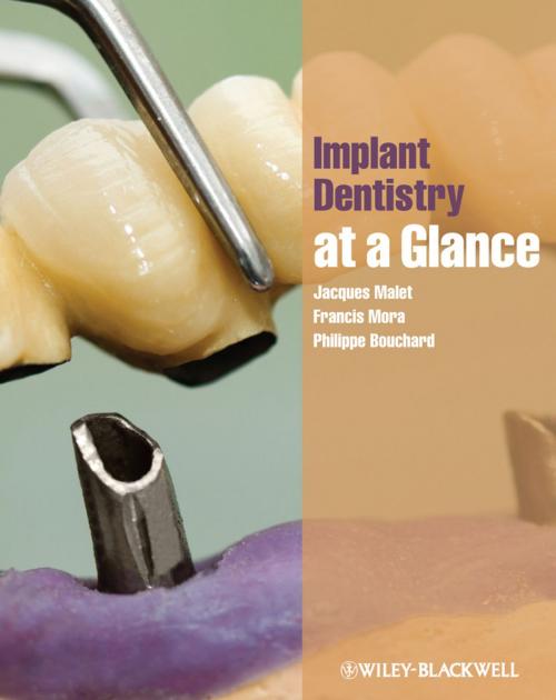 Cover of the book Implant Dentistry at a Glance by Jacques Malet, Francis Mora, Philippe Bouchard, Wiley