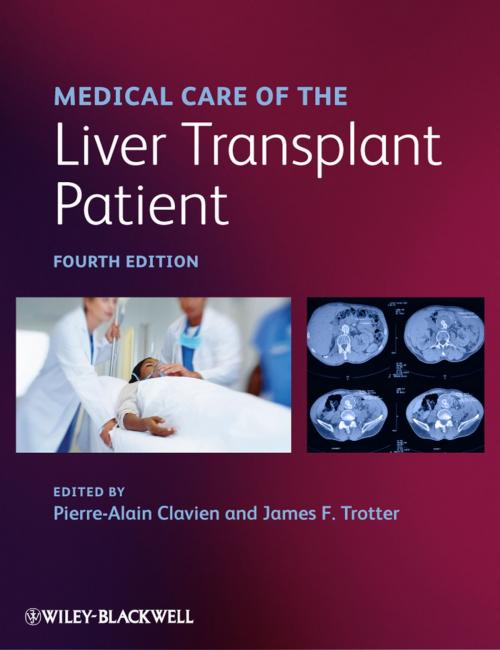 Cover of the book Medical Care of the Liver Transplant Patient by , Wiley