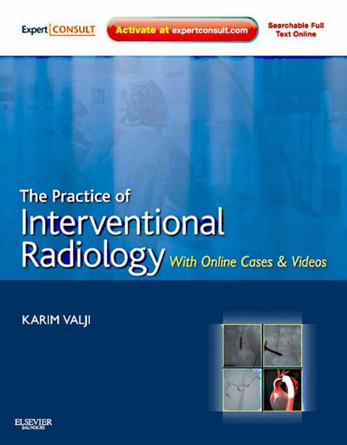 Cover of the book The Practice of Interventional Radiology, with Online Cases and Video E-Book by Karim Valji, MD, Elsevier Health Sciences