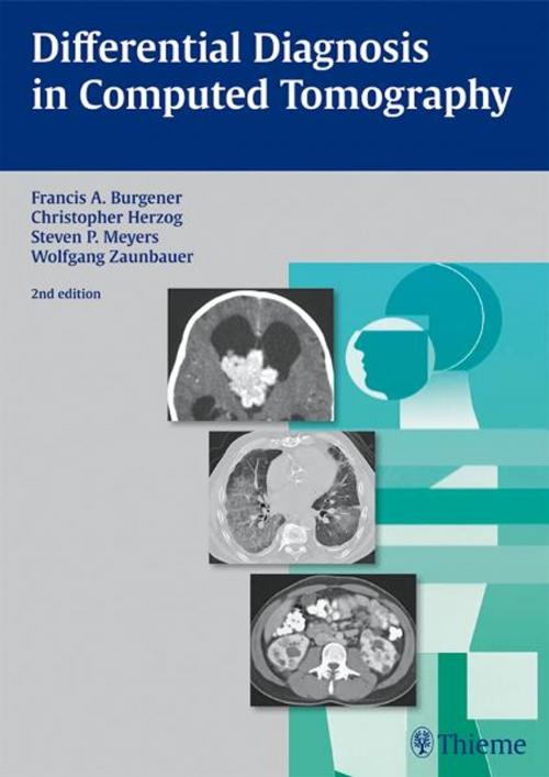 Cover of the book Differential Diagnosis in Computed Tomography by Christopher Herzog, Francis A. Burgener, Thieme