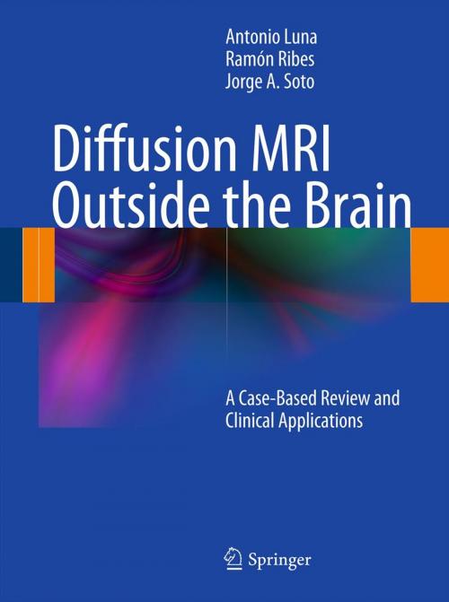 Cover of the book Diffusion MRI Outside the Brain by Antonio Luna, Ramón Ribes, Jorge A. Soto, Springer Berlin Heidelberg
