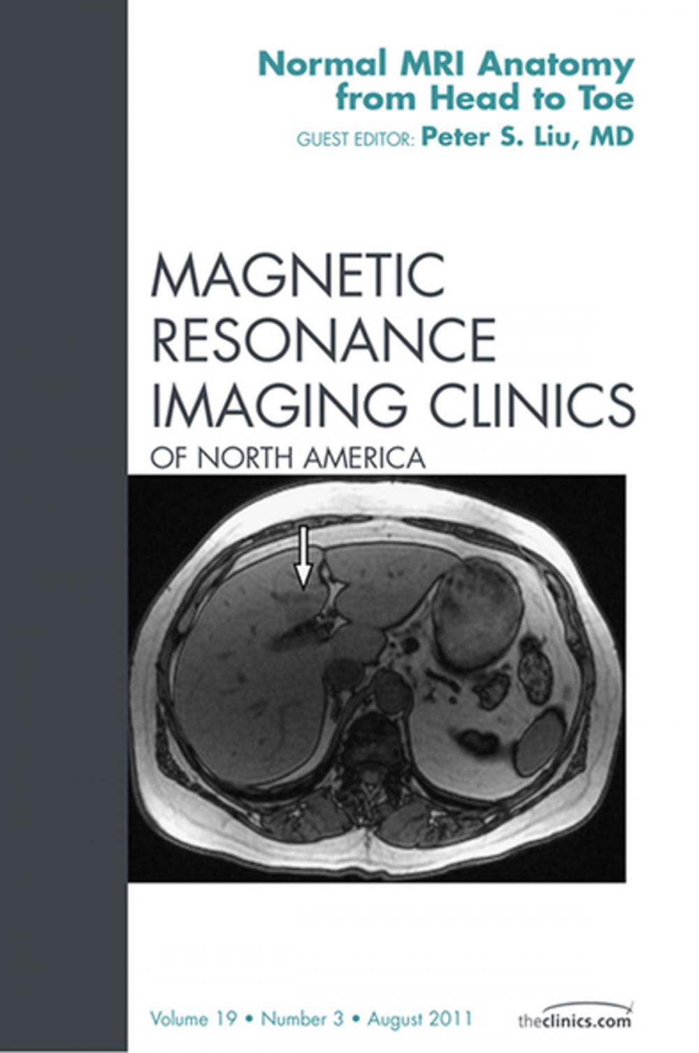 Big bigCover of Normal MR Anatomy, An Issue of Magnetic Resonance Imaging Clinics - E-Book