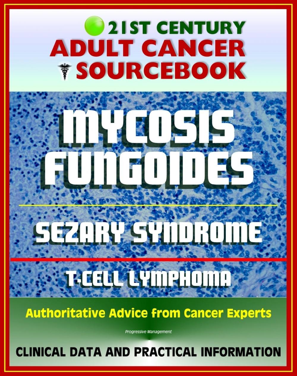 Big bigCover of 21st Century Adult Cancer Sourcebook: Mycosis Fungoides and the Sezary Syndrome, Cutaneous T-cell Lymphoma. - Clinical Data for Patients, Families, and Physicians