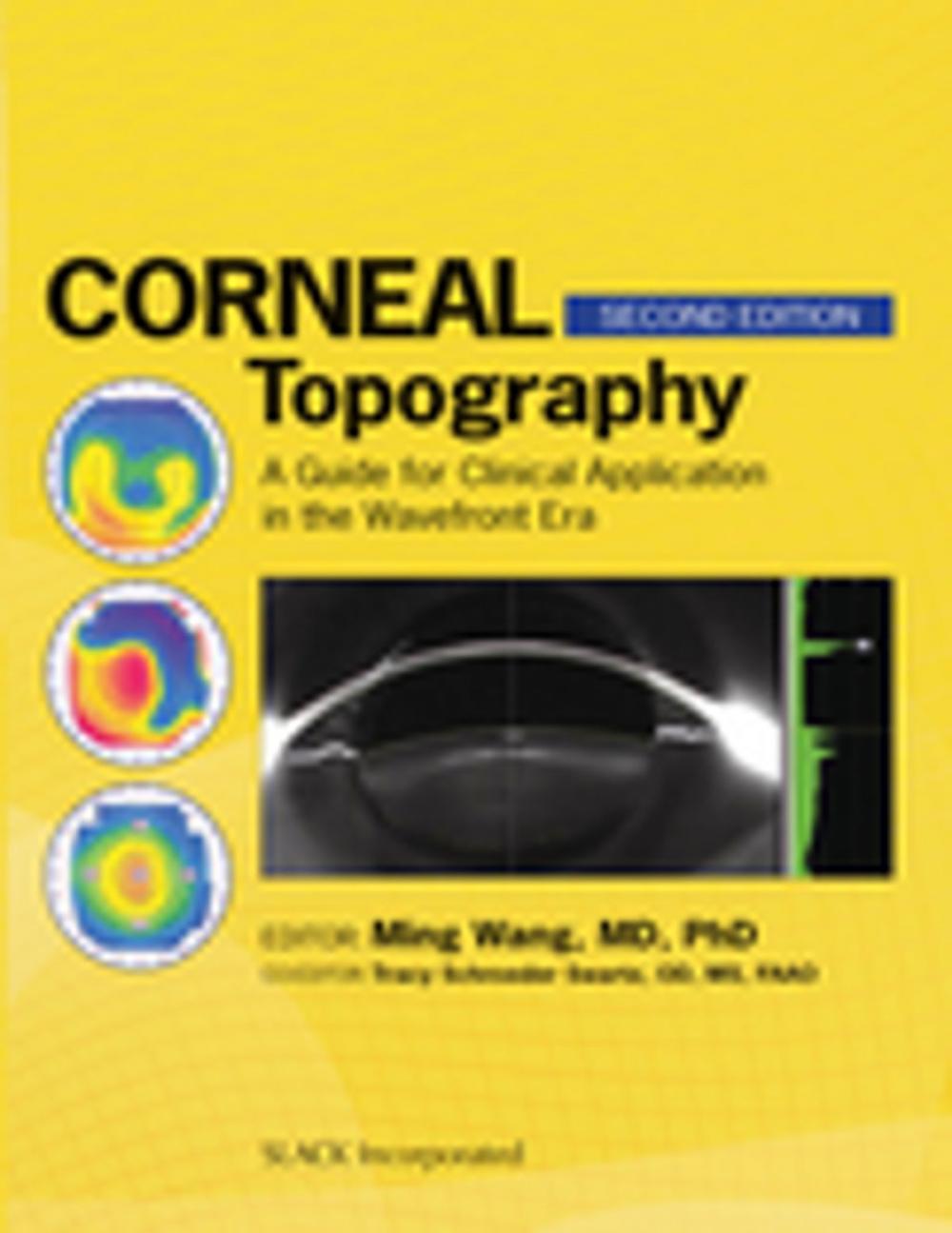 Big bigCover of Corneal Topography