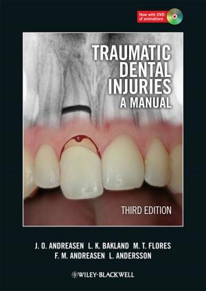 Book cover of Traumatic Dental Injuries