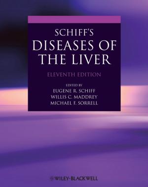 Cover of the book Schiff's Diseases of the Liver by Erik Hellman