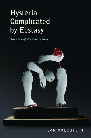 Cover of the book Hysteria Complicated by Ecstasy by Dennis Paulson