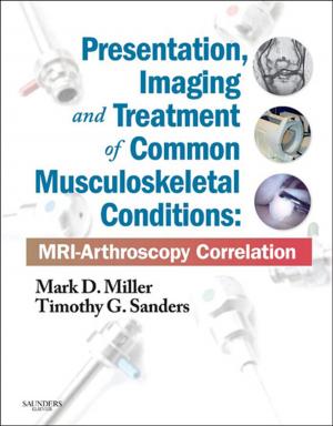 Book cover of Presentation, Imaging and Treatment of Common Musculoskeletal Conditions E-Book