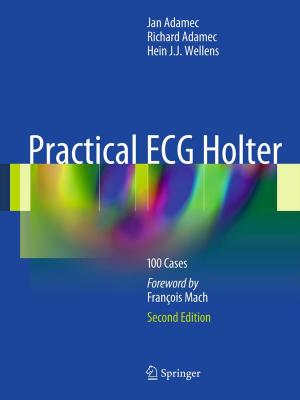 Cover of the book Practical ECG Holter by Dawn A. Marcus, Philip A. Bain