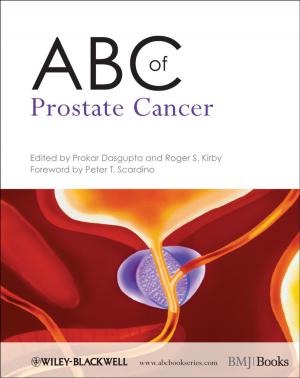 Cover of the book ABC of Prostate Cancer by George Irvin