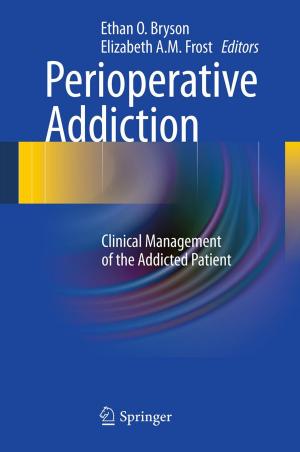 Cover of the book Perioperative Addiction by Jessica Feng Sanford, Miodrag Potkonjak, Sasha Slijepcevic