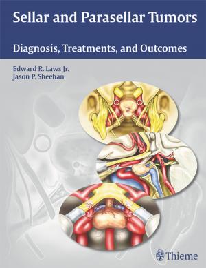 Cover of the book Sellar and Parasellar Tumors by Yingze Zhang