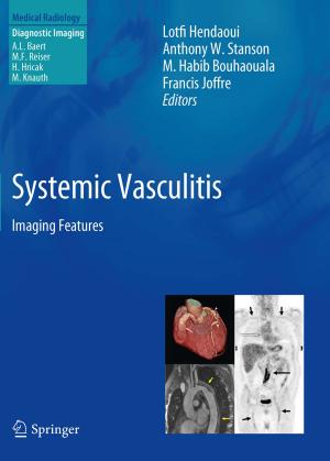 Cover of the book Systemic Vasculitis by Vijayan Krishnaraj, Redouane Zitoune, J. Paulo Davim