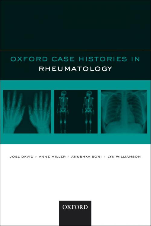 Cover of the book Oxford Case Histories in Rheumatology by Joel David, Anne Miller, Anushka Soni, Lyn Williamson, OUP Oxford