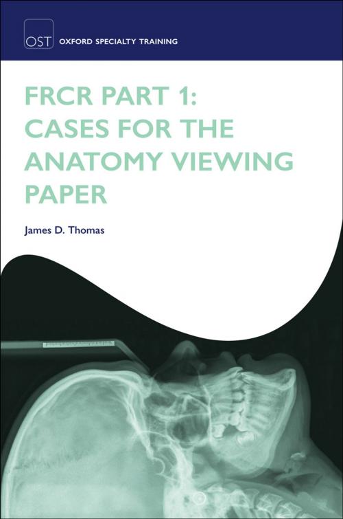 Cover of the book FRCR Part 1: Cases for the anatomy viewing paper by James D. Thomas, OUP Oxford
