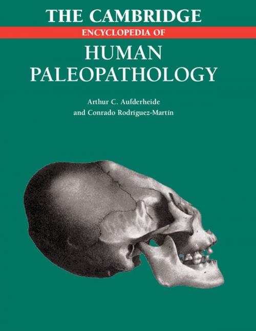 Cover of the book The Cambridge Encyclopedia of Human Paleopathology by Arthur C. Aufderheide, Conrado Rodriguez-Martin, Cambridge University Press