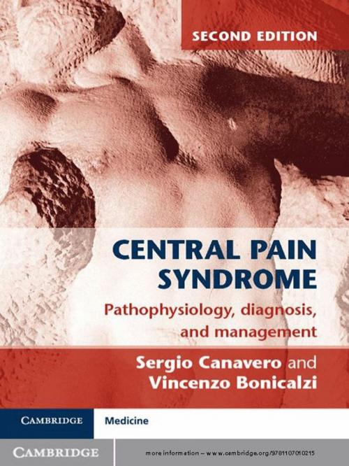 Cover of the book Central Pain Syndrome by Sergio Canavero, Vincenzo Bonicalzi, Cambridge University Press