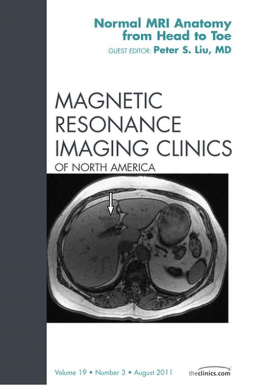 Cover of the book Normal MR Anatomy, An Issue of Magnetic Resonance Imaging Clinics - E-Book by Peter S. Liu, MD, Elsevier Health Sciences
