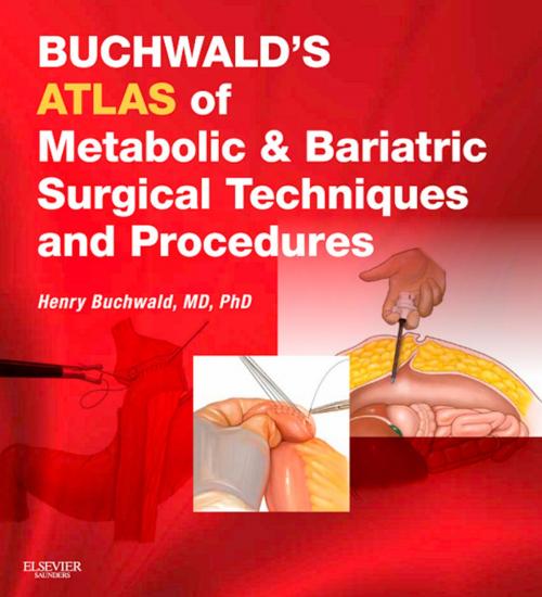 Cover of the book Buchwald's Atlas of Metabolic & Bariatric Surgical Techniques and Procedures E-Book by Henry Buchwald, MD, PhD, Elsevier Health Sciences