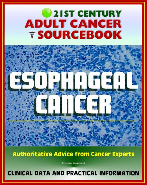 Cover of the book 21st Century Adult Cancer Sourcebook: Esophageal Cancer (Cancer of the Esophagus) - Clinical Data for Patients, Families, and Physicians by Progressive Management, Progressive Management