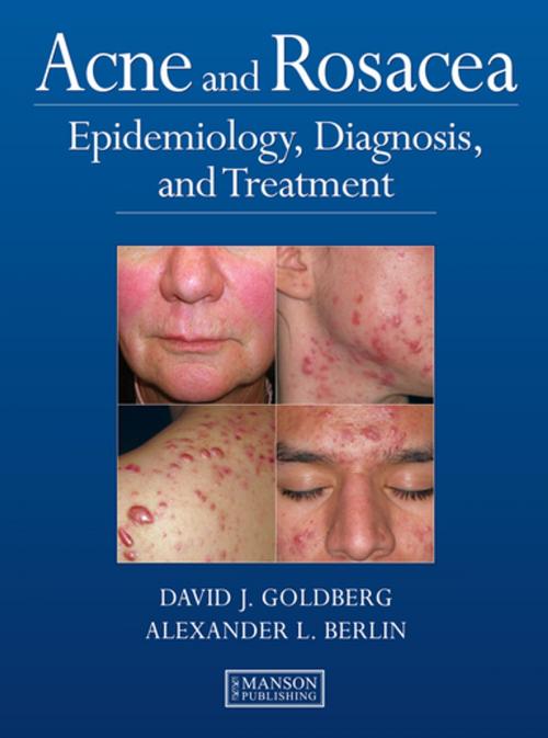 Cover of the book Acne and Rosacea by David Goldberg, Alexander Berlin, CRC Press