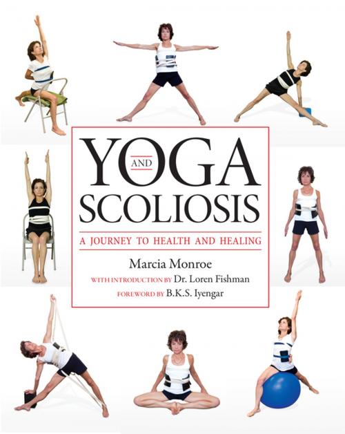 Cover of the book Yoga and Scoliosis by Marcia Monroe, Springer Publishing Company