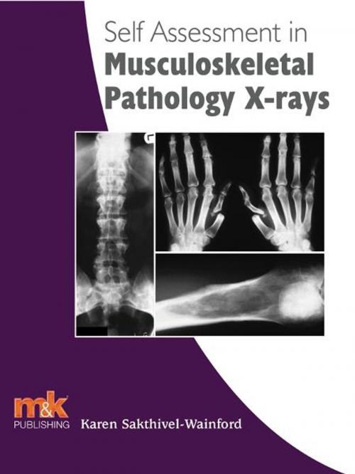 Cover of the book Self-assessment in Musculoskeletal Pathology X-rays by Karen Sakthivel-Wainford, M&K Update Ltd