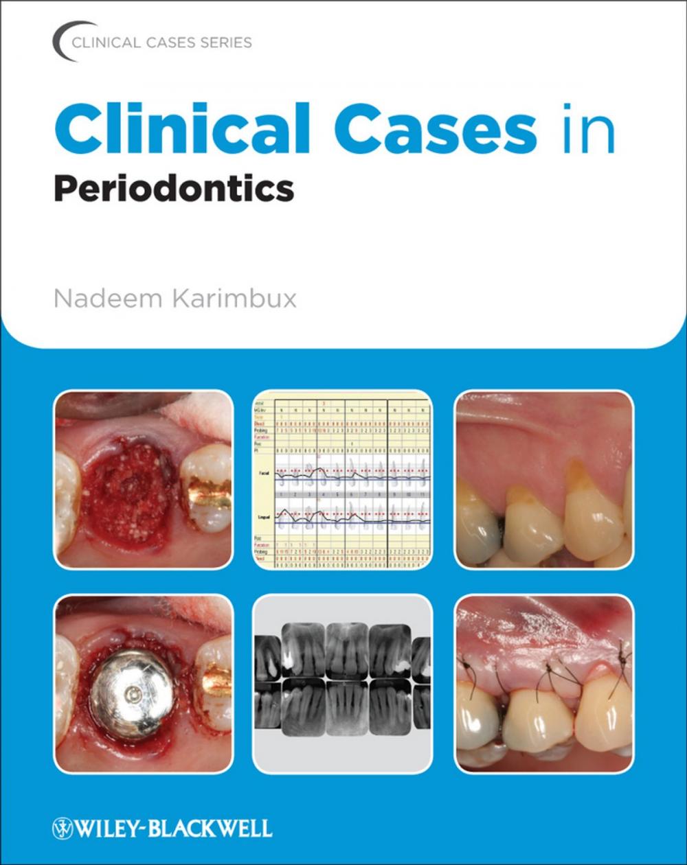 Big bigCover of Clinical Cases in Periodontics