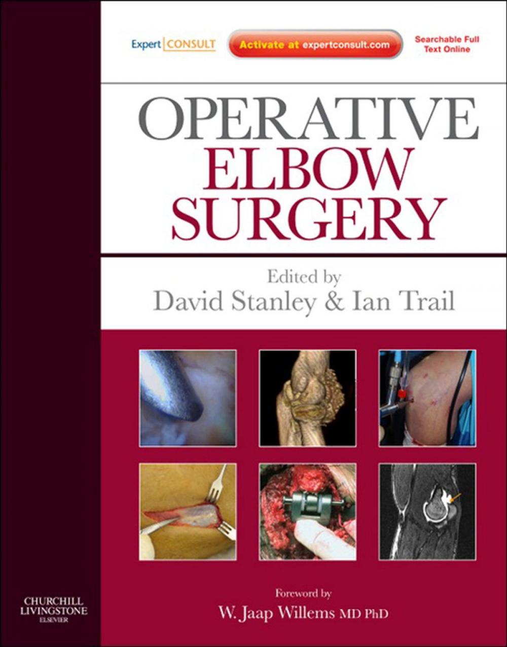 Big bigCover of Operative Elbow Surgery E-Book