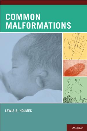 Cover of the book Common Malformations by Ennis Barrington Edmonds