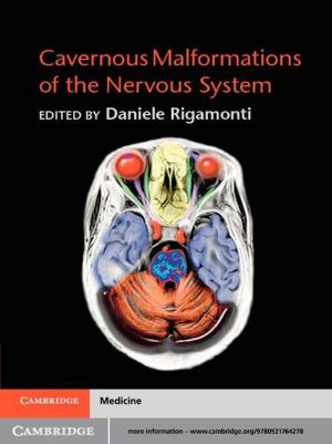 Cover of the book Cavernous Malformations of the Nervous System by Karl Bell