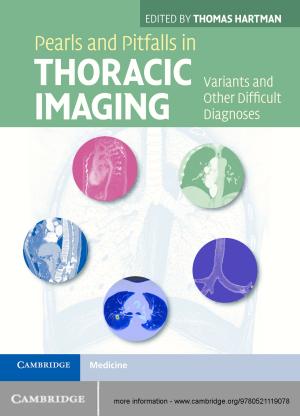 Cover of the book Pearls and Pitfalls in Thoracic Imaging by Daniel W. Gingerich