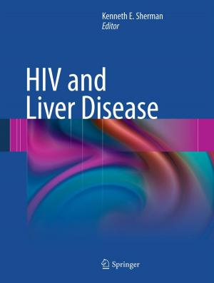Cover of the book HIV and Liver Disease by Zdeněk Dostál, Tomáš Kozubek, Marie Sadowská, Vít Vondrák