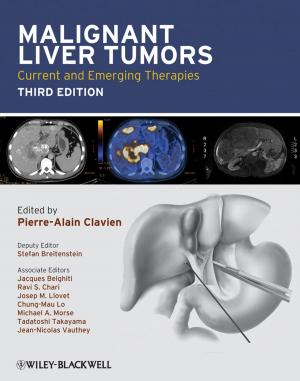 Book cover of Malignant Liver Tumors
