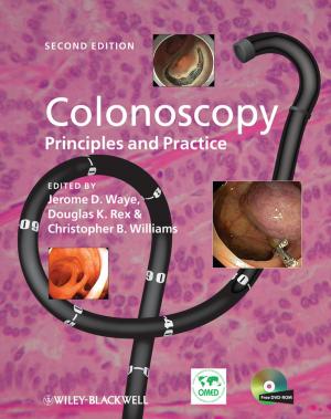 Cover of the book Colonoscopy by Ian Pouncey, Richard York