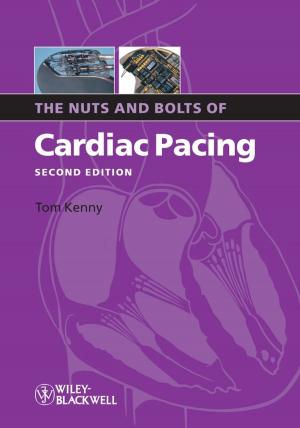 Cover of the book The Nuts and Bolts of Cardiac Pacing by Franco Taroni, Alex Biedermann, Silvia Bozza, Paolo Garbolino, Colin Aitken