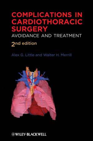 Cover of the book Complications in Cardiothoracic Surgery by Frank Ryan